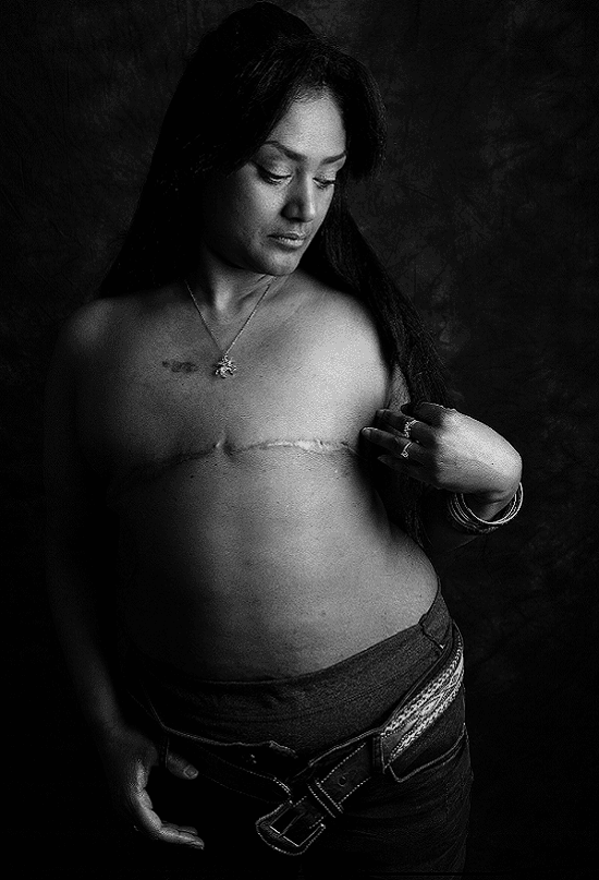 SU2C hosts powerful 'defiance' photo series image of Sherry.